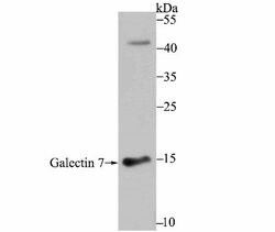 Galectin-7 Antibody (JB38-11), Novus Biologicals 100 &mu;l; Unconjugated:Antibodies,